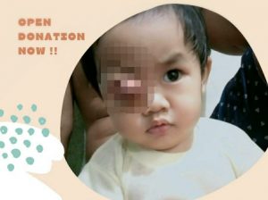 Penggalangan Dana untuk Pengobatan Muhammad Aditya Zainul Mutaqim